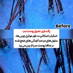 کراتین و اسکراب اسکالپ حانیه شکرانه