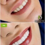 کلینیک دندانپزشکی دیبا(قرارداد با بیمه)