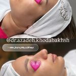 مطب زیبایی آرا