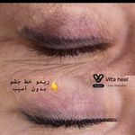 خدمات تخصصی ریمو تتو آزیتا