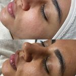 مرکز تخصصی فیشیال حانیه سیمابی