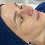 فیشال و پاکسازی تخصصی پوست تحت نظر پزشک