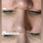 مرکز لیزر ،پوست و زیبایی کندی بیوتی
