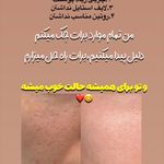 کلینیک فیشال و ماساژ سارن اسکین سارا