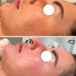 خدمات پاکسازی پوست و اسکالپ سر نازنین