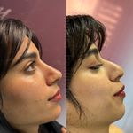 کلینیک زیبایی و مرکز لیزر هانیسا