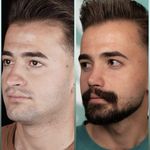 دکتر فرهاد محرابی سی سخت