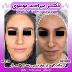 دکترمیراحدموسوی