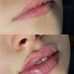 کلینیک پوست و زیبایی ژیلاوَش