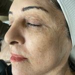 پاکسازی پوست/جوان سازی /جعفری