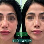 کلینیک زیبایی فرتاک