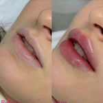 کلینیک پوست و زیبایی ژیلاوَش