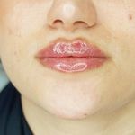 کلینیک تخصصی لیزر موهای زائد پریناز شرق