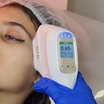 مرکز لیزر ،پوست و زیبایی کندی بیوتی