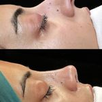 مرکز جراحی زیبایی بینی