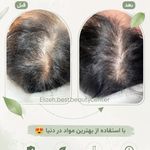 کلینیک زیبایی الیزه