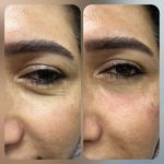 کلینیک لیزر و زیبایی مهرُنا