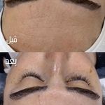 اسکین تراپیست علیزاده فیش/ آموزش صفرتاصد