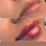 کلینیک پوست و مو زیبایی اُکتا - کرج - 7334