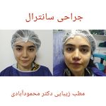 مركز ليزر و مطب زيبايی دكتر محمودآبادی