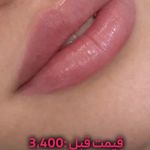 کلینیک زیبایی شایلی