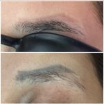 مرکز لیزر و پاکسازی پوست روژین