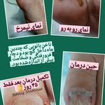 بهناز شب بویی زنجان (با علم پودولوژی) (Ad)