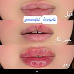 کلینیک زیبایی یاس سفید