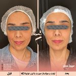 مرکز پزشکی و زیبایی میروژ سنتر