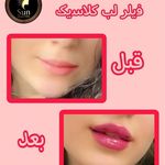 کلینیک زیبایی سان رایس