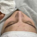 پاکسازی پوست،فشیال تخصصی در رودسر