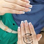 خدمات کاشت و ترمیم ناخن هدیه