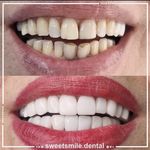 مطب دندان پزشکی لبخند شیرین
