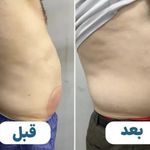 کلینیک پوست مو لیزر و لاغری عصر زیبایی