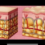 لاغری موضعی تضمینی فروغ فصیحی تخفیف ویژه