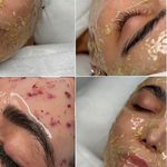 فیشیال آئورا -شبنم جلالی