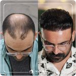 کلینیک پوست مو و زیبایی نوین ایرانا