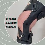 کلینیک ارتوپدی فنی مهر ( اسکن کف پا)