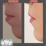 دکتر دندانپزشک و ارتودنسی دکتر یحیی پور