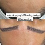 مرکز زیبایی وخدمات لیزر و فیشیال تراپی