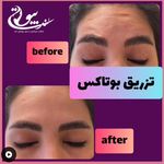 مجموعه پوست مو زیبایی بیوتی لند شریعتی