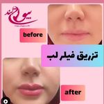 مجموعه پوست مو زیبایی بیوتی لند شریعتی