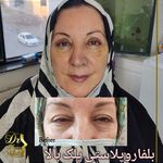 مرکز لیزر کلینیک زیبایی دکتر نگار وکیلی