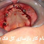 مرکز تخصصی ایمپلنت و دندانپزشکی ژیوان