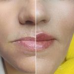 مرکز لیزر کلینیک زیبایی دکتر نگار وکیلی