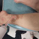 مرکز زخم وزخم دیابتی عادل فلاح