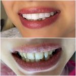 دندانپزشکی دکتر زیبا نورعلی