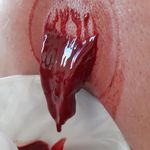 درمانگر طب سوزنی ماساژ درمانی علیرضانظری