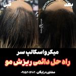 اولین مرکز تخصصی میکرواسکالپ در شرق کشور