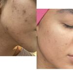خدمات تخصصی فیشیال آیسو